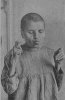 Кататония